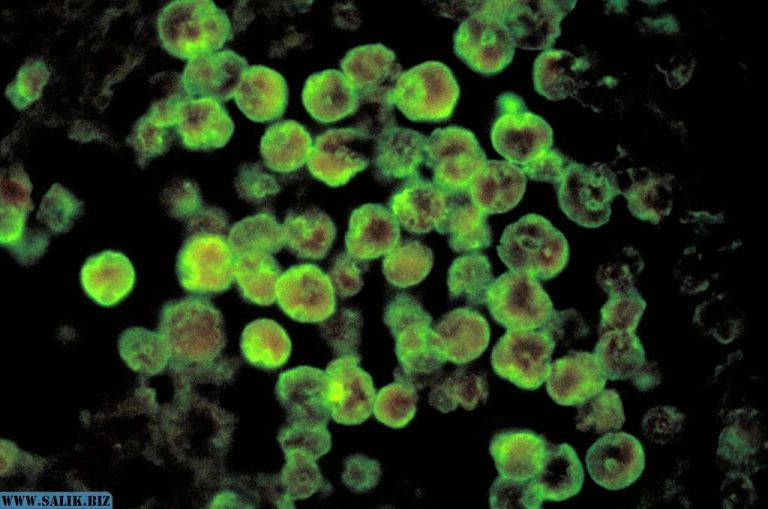 e18c86e7a7b5ff9ef7cefef0c2a11582