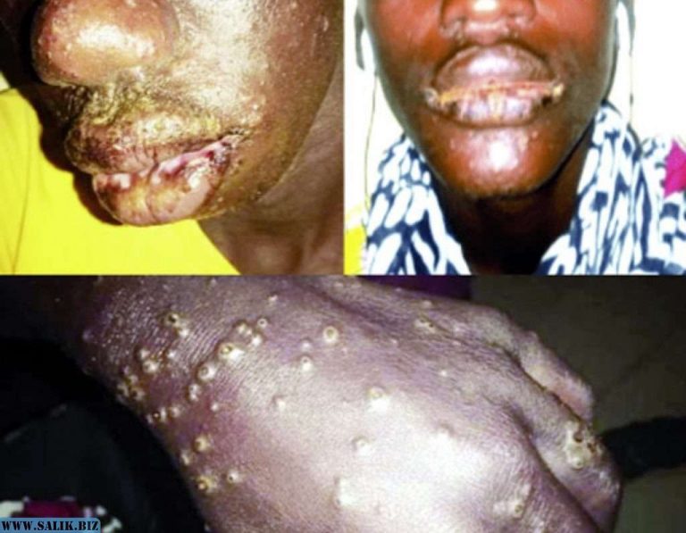 66e447f198cd768e34b66068149d5d8d