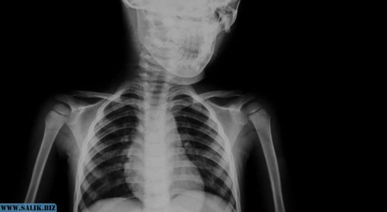 d455bb29dcbb2c94178e67cac2920195